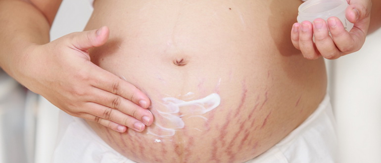 Крем от растяжек для беременных: обзор лучших