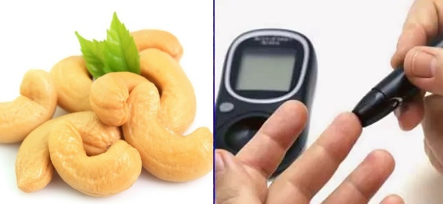 Кешью при сахарном диабете 2 типа