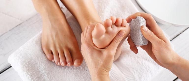 Как избавиться от сухих и других видов мозолей на пальцах ног в домашних условиях